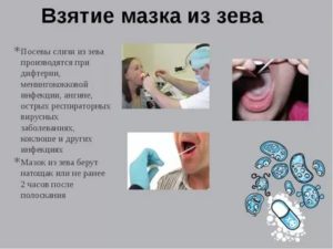 Техника взятия мазка из зева и носа