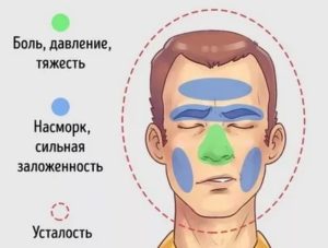 Боль в области переносицы и лба