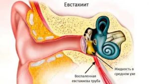 Жидкость во внутреннем ухе