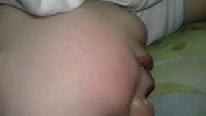 Красные щеки у ребенка 1 год