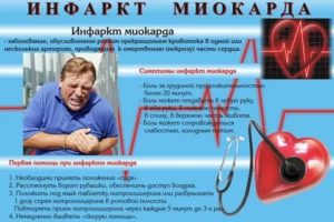 Одышка после инфаркта миокарда лечение