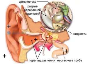 Почему давит на уши изнутри