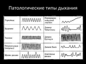 Громкое дыхание причины