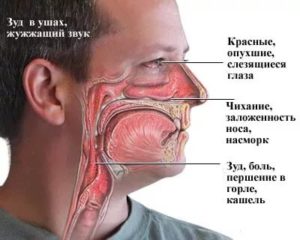 Щекочет в носу и слезятся глаза