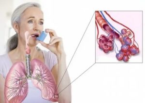 Заразна ли бронхиальная астма