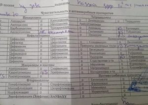 Бак посев из носоглотки