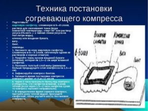 Постановка местного согревающего компресса