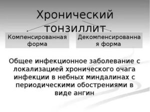 Хронический тонзиллит субкомпенсированная форма