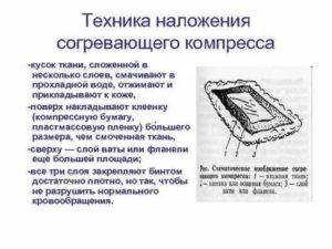 Для постановки согревающего компресса приготовить