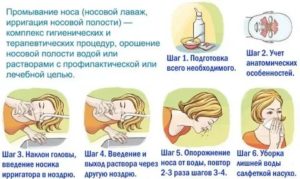 Промывание носа хозяйственным мылом