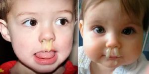 У двухмесячного ребенка сопли что делать