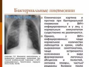 Бактериальная пневмония симптомы и лечение