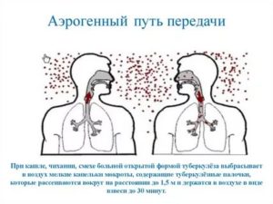 Аэрогенный путь заражения