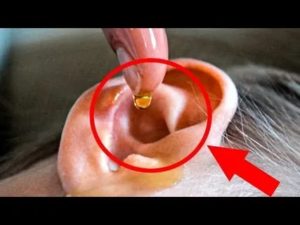 Много серы в ушах у взрослых причины
