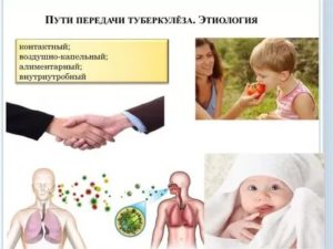 Наиболее распространенный путь передачи туберкулеза