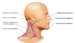 Где находятся подчелюстные лимфоузлы фото