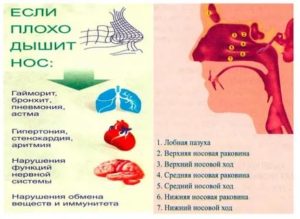 Постоянно не дышит нос что делать