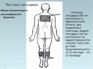 Электрофорез с бромом на воротниковую зону показания