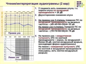 Аудиограмма расшифровка таблица норма