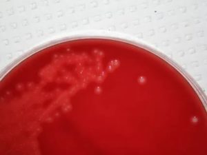Streptococcus agalactiae лечение