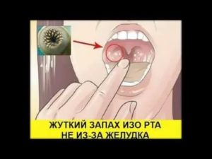 Запах гноя изо рта причины