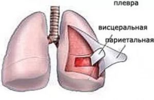 Уплотнение плевры легкого причины