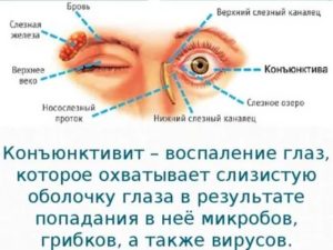 Воспаление глаз при простуде лечение