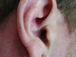 Болячка на ушной раковине у человека