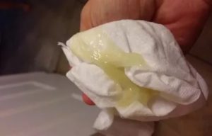 Белые желеобразные выделения