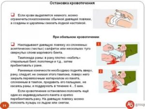 Как остановить кровь из вены на запястье