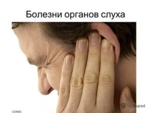 Удар по ушам ладонями последствия