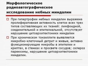 Исследование функции небных миндалин