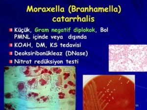 Branhamella catarrhalis в носу у ребенка