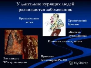 Курение при бронхиальной астме последствия