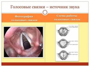 Несмыкание голосовых связок лечение