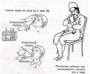 Техника взятия мазка из зева и носа