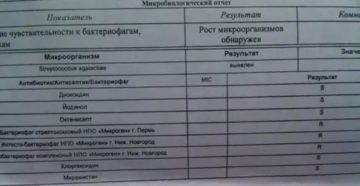 Стрептококк агалактия в мазке при беременности