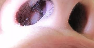 Шишки в носу у ребенка Шишки в носу у ребенка