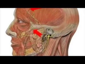 Застудила тройничный нерв симптомы
