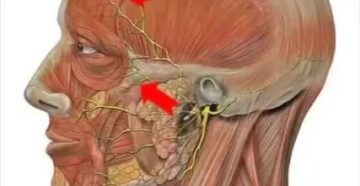 Застудила тройничный нерв симптомы