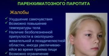 Неспецифический паротит у детей Неспецифический паротит у детей