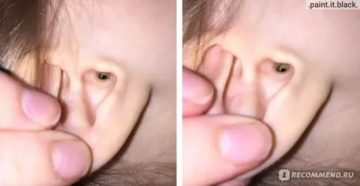 Запах из уха у ребенка причины