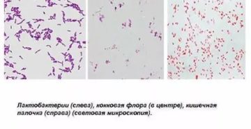 Кокковая флора в носу у ребенка