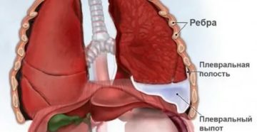 Покалывание в легких