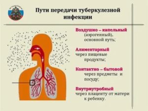 Наиболее распространенный путь передачи туберкулеза