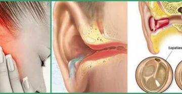 Не продувается одно ухо