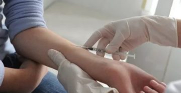 Как подготовить ребенка к манту