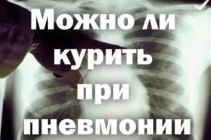 Можно ли курить после пневмонии