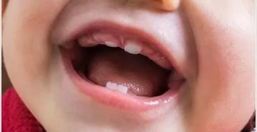 Орви на фоне прорезывания зубов