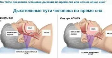 Задержка дыхания во сне у взрослых причины